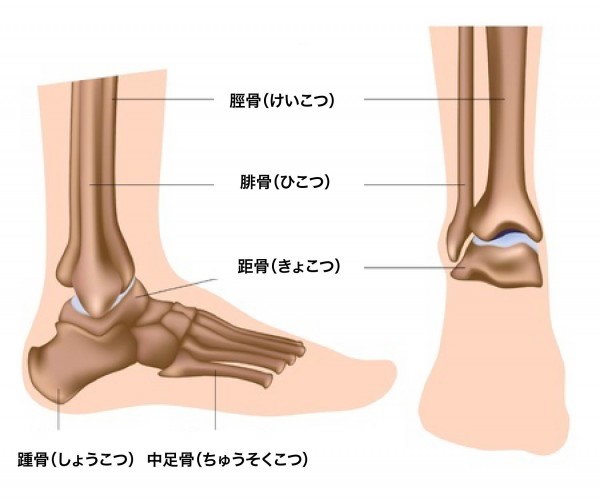 外反母趾